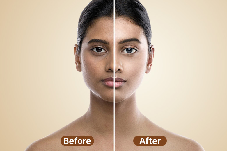 Best Dermatology in Surat for Advanced Skin and Hair Care