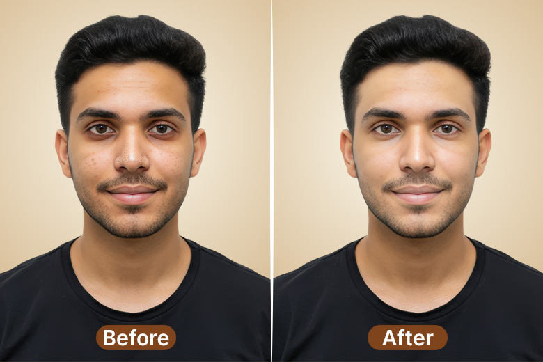 Pre-Wedding Groom Skin & Hair Care Before After